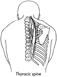 Diagram of intercosatl block anatony from behind