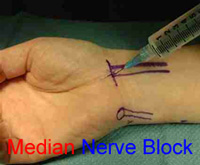 Median Nerve Anatomy Wrist