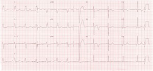 Wellen syndrome