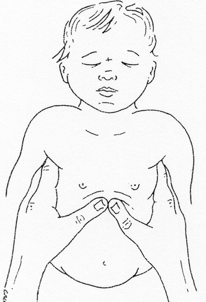 Compressions Infant
