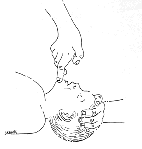 Chin lift infant