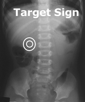 Target sign