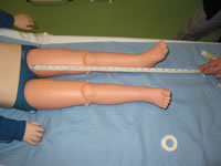 Measuring Thomas Splint