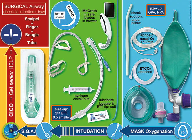 RSI Kit preparation