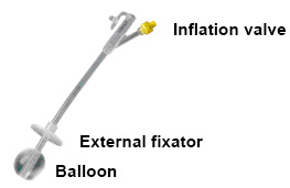 Gastrostomy Tube