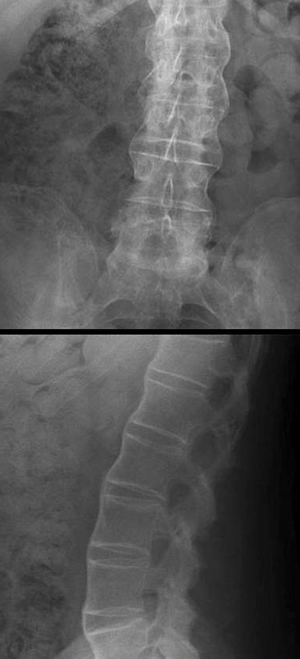 Bamboo spine
