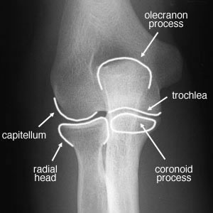 Elbow AP view labelled