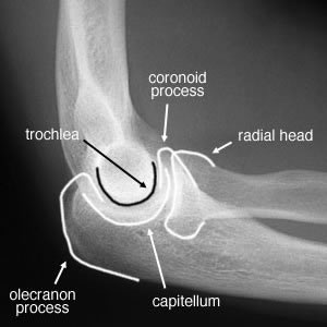 Elbow lateral view labelled