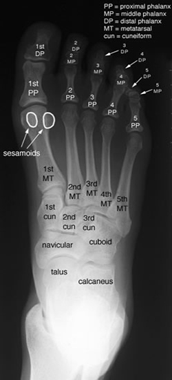 Foot AP Labelled