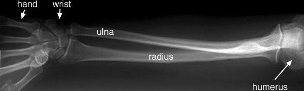 Forearm AP view labelled