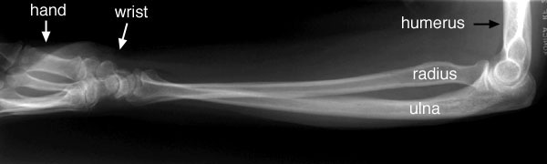 Forearm lateral view labelled