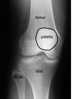 Knee AP labelled