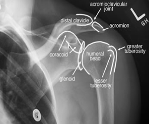 Elbow shoulder AP labelled