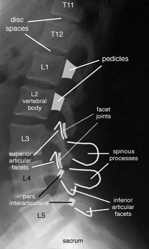 L spine lateral
