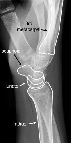Wrist lateral view labelled