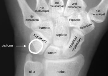 Wrist PA view labelled